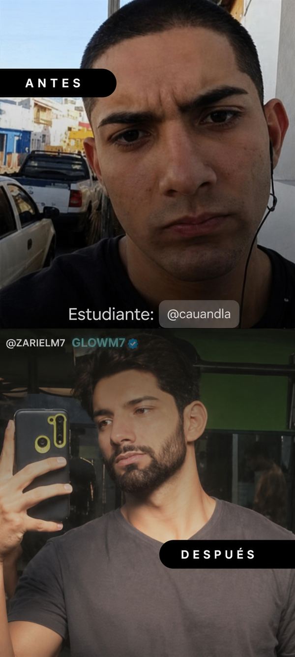 Antes y Después Alumno GLOWM7